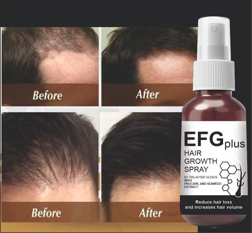 Hair Growth Spray
