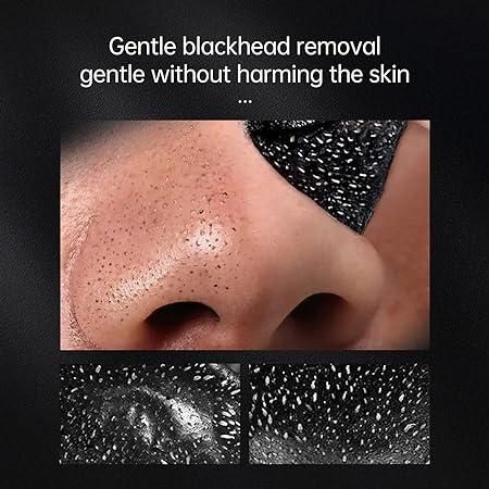 Blackhead Treatment Peeling Mask