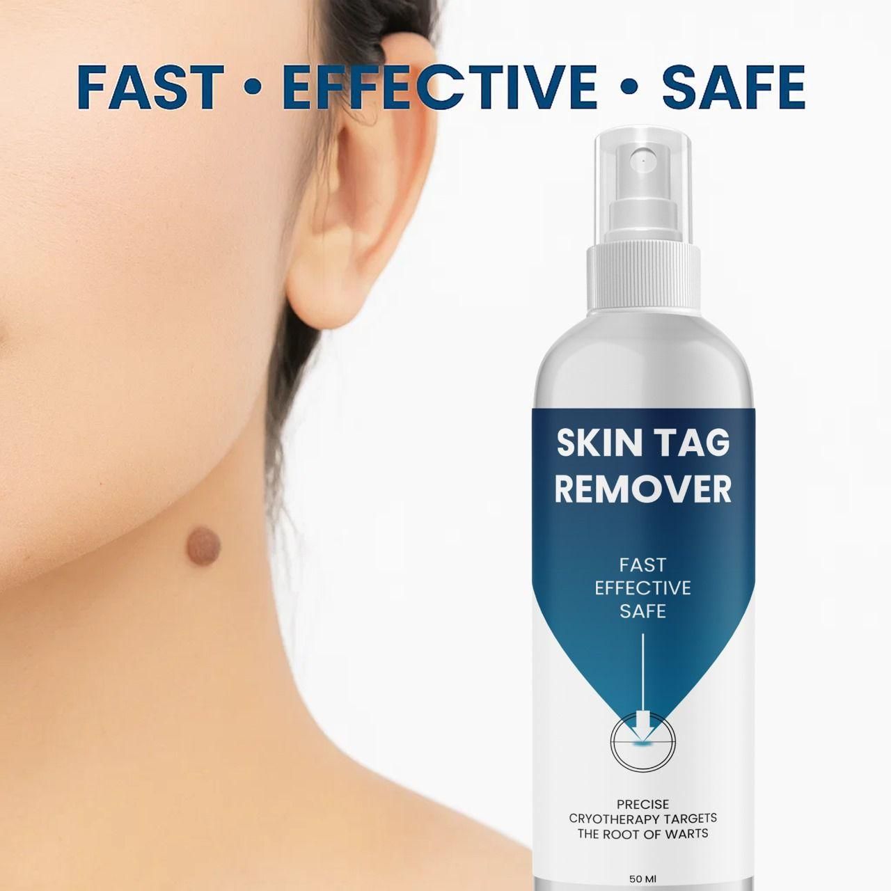 Skin Tag Remover