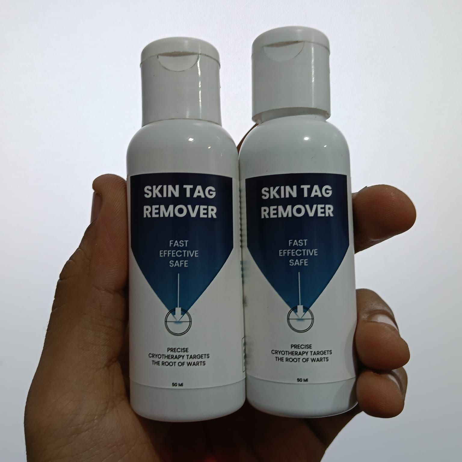 Skin Tag Remover